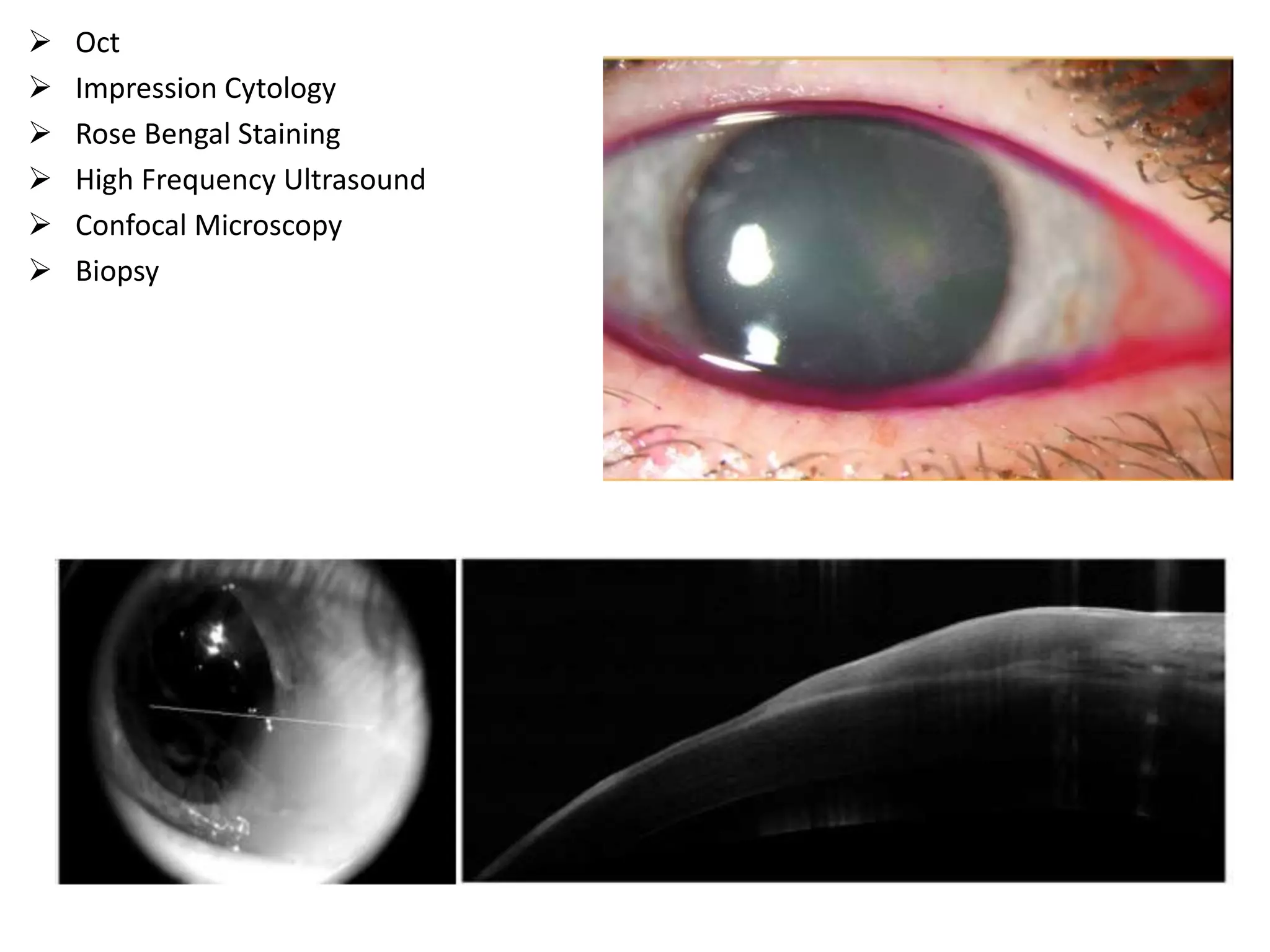  Oct
 Impression Cytology
 Rose Bengal Staining
 High Frequency Ultrasound
 Confocal Microscopy
 Biopsy
 