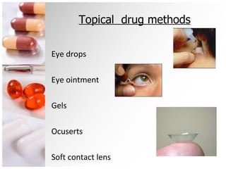 Topical  drug methods Eye drops Eye ointment Gels Ocuserts Soft contact lens 