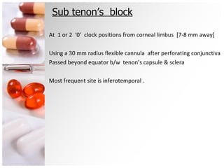 Sub tenon’s  block At  1 or 2  ‘0’  clock positions from corneal limbus  [7-8 mm away] Using a 30 mm radius flexible cannula  after perforating conjunctiva  Passed beyond equator b/w  tenon’s capsule & sclera Most frequent site is inferotemporal . 