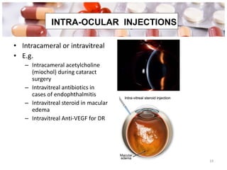 Intraocular injections Intracameral or intravitreal E.g. Intracameral acetylcholine (miochol) during cataract surgery Intravitreal antibiotics in cases of endophthalmitis Intravitreal steroid in macular edema Intravitreal Anti-VEGF for DR INTRA-OCULAR  INJECTIONS 