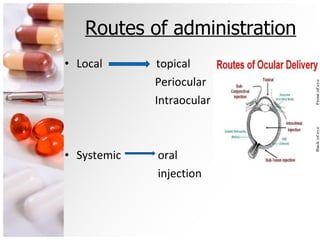 Routes of administration Local  topical Periocular Intraocular Systemic  oral injection 