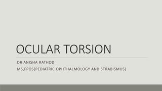 OCULAR TORSION
DR ANISHA RATHOD
MS,FPOS(PEDIATRIC OPHTHALMOLOGY AND STRABISMUS)
 