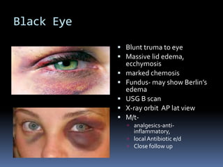 Black Eye
 Blunt truma to eye
 Massive lid edema,
ecchymosis
 marked chemosis
 Fundus- may show Berlin’s
edema
 USG B scan
 X-ray orbit AP lat view
 M/t-
 analgesics-anti-
inflammatory,
 localAntibiotic e/d
 Close follow up
 