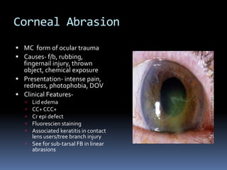 Corneal Abrasion
 MC form of ocular trauma
 Causes- f/b, rubbing,
fingernail injury, thrown
object, chemical exposure
 Presentation- intense pain,
redness, photophobia, DOV
 Clinical Features-
 Lid edema
 CC+ CCC+
 Cr epi defect
 Fluorescien staining
 Associated keratitis in contact
lens users/tree branch injury
 See for sub-tarsal FB in linear
abrasions
 