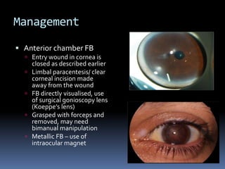 Management
 Anterior chamber FB
 Entry wound in cornea is
closed as described earlier
 Limbal paracentesis/ clear
corneal incision made
away from the wound
 FB directly visualised, use
of surgical gonioscopy lens
(Koeppe’s lens)
 Grasped with forceps and
removed, may need
bimanual manipulation
 Metallic FB – use of
intraocular magnet
 
