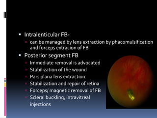  Intralenticular FB-
 can be managed by lens extraction by phacomulsification
and forceps extracion of FB
 Posterior segment FB
 Immediate removal is advocated
 Stabilization of the wound
 Pars plana lens extraction
 Stabilization and repair of retina
 Forceps/ magnetic removal of FB
 Scleral buckling, intravitreal
injections
 
