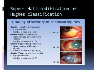 Roper- Hall modification of
Hughes classification
 