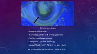 Corneal Abrasion Net
-Distinguish from ulcer
-Rx with topical Abs with cycloplegia alone
-Patching not always necessary
-Therapeutic CL (close follow up)
- topical NSAIDs for 1st 24-48 hrs … pain relieve
Ref: AAO External eye disease and Cornea 2016-2017
 