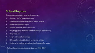 Scleral Rupture
The most common sites for scleral rupture are
1. Limbus … site of previous surgery
2. Parallel to and under insertion of rectus muscle
• Important diagnostic signs
1. Marked decrease in ocular duction
2. Very boggy conj chemosis with hemorrhage (ecchymosis)
3. Deepened AC
4. Severe Vitreous hemorrhage
 IOP usually reduced but may be normal or high
 Peritomy is required to explore site of rupture for repair
Ref: AAO external eye disease and cornea 2016-2017
 