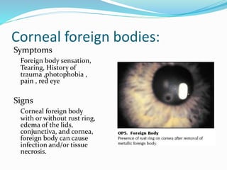 Corneal foreign bodies:
Symptoms
Foreign body sensation,
Tearing, History of
trauma ,photophobia ,
pain , red eye
Signs
Corneal foreign body
with or without rust ring,
edema of the lids,
conjunctiva, and cornea,
foreign body can cause
infection and/or tissue
necrosis.
 