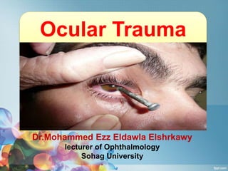 By
Dr.Mohammed Ezz Eldawla Elshrkawy
lecturer of Ophthalmology
Sohag University
Ocular Trauma
 