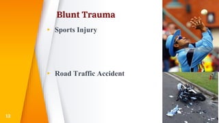 Blunt Trauma
▸ Sports Injury
▸ Road Traffic Accident
12
 