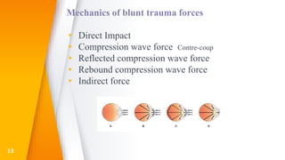 Mechanics of blunt trauma forces
▸ Direct Impact
▸ Compression wave force Contre-coup
▸ Reflected compression wave force
▸ Rebound compression wave force
▸ Indirect force
13
 