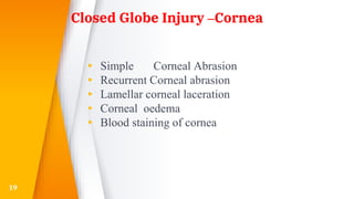 Closed Globe Injury –Cornea
▸ Simple Corneal Abrasion
▸ Recurrent Corneal abrasion
▸ Lamellar corneal laceration
▸ Corneal oedema
▸ Blood staining of cornea
19
 