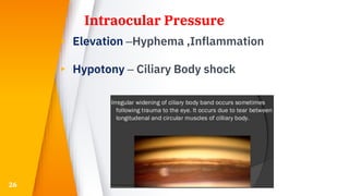 Intraocular Pressure
▸ Elevation –Hyphema ,Inflammation
▸ Hypotony – Ciliary Body shock
26
 