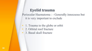 Eyelid trauma
Periocular Haematoma : - Generally innocuous but
it is very important to exclude
▸ 1. Trauma to the globe or orbit
▸ 2. Orbital roof fracture
▸ 3. Basal skull fracture
30
 