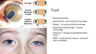 Ocular trauma | PPTX