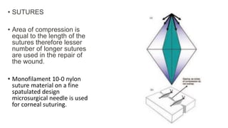 Lesser Compression Ocular trauma 𝟮.pptx ocular trauma pptx | PPTX
