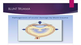 Comprehensive Overview of Ocular Trauma: Blunt, Penetrating, and ...