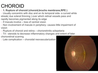 Blunt Ocular trauma | PPTX
