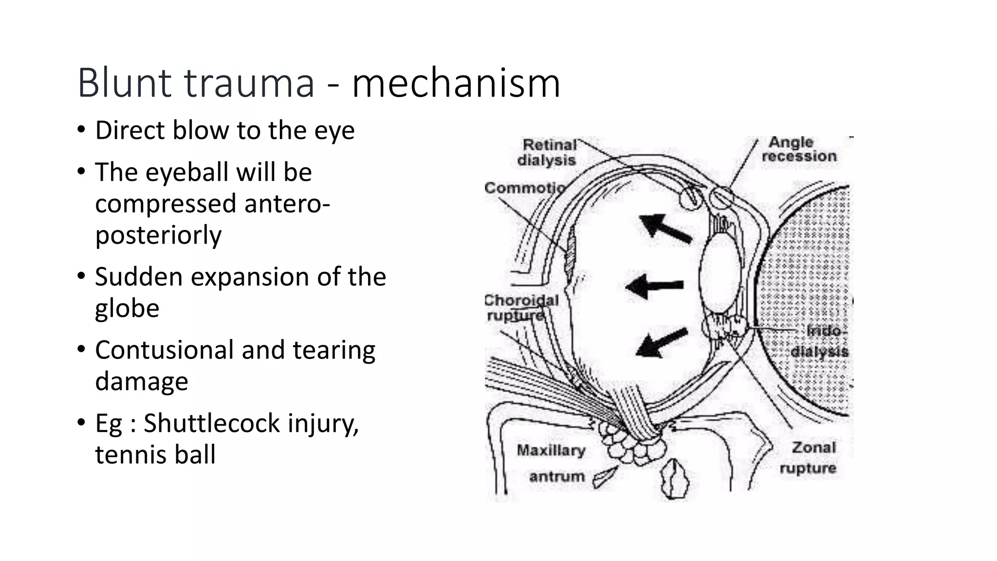 Ocular Trauma .pptx