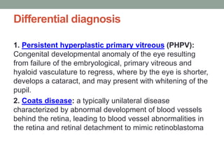 Pphpv Eye Tumors of the eye | PPTX