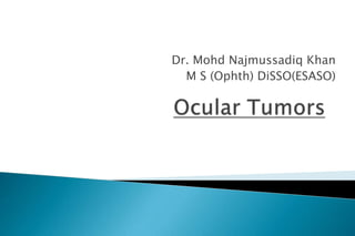 Dr. Mohd Najmussadiq Khan
M S (Ophth) DiSSO(ESASO)
 
