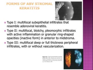 Multifocal Infiltrates OCULAR VIRAL ILLNESSES with different ocular manifestations | PPTX