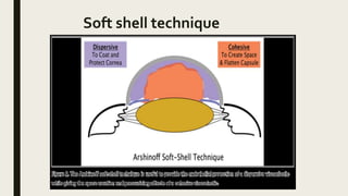 Soft shell technique
 