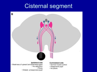 Cisternal segment
 