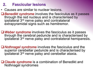 2. Fascicular lesions
• Causes are similar to nuclear lesions.
Benedikt syndrome involves the fasciculus as it passes
through the red nucleus and is characterised by
ipsilateral 3rd nerve palsy and contralateral
extrapyramidal signs such as hemitremor.
Weber syndrome involves the fasciculus as it passes
through the cerebral peduncle and is characterised by
ipsilateral 3rd nerve palsy and contralateral hemiparesis.
Nothnagel syndrome involves the fasciculus and the
superior cerebellar peduncle and is characterised by
ipsilateral 3rd nerve palsy and cerebellar ataxia.
Claude syndrome is a combination of Benedikt and
Nothnagel syndromes
 