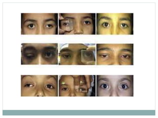 oculomotor nerve.pptx