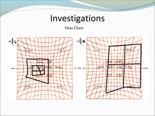 Investigations
Hess Chart
 