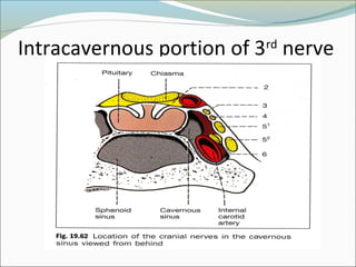Intracavernous portion of 3rd
nerve
 