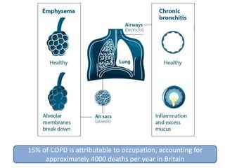 15% of COPD is attributable to occupation, accounting for
approximately 4000 deaths per year in Britain
 