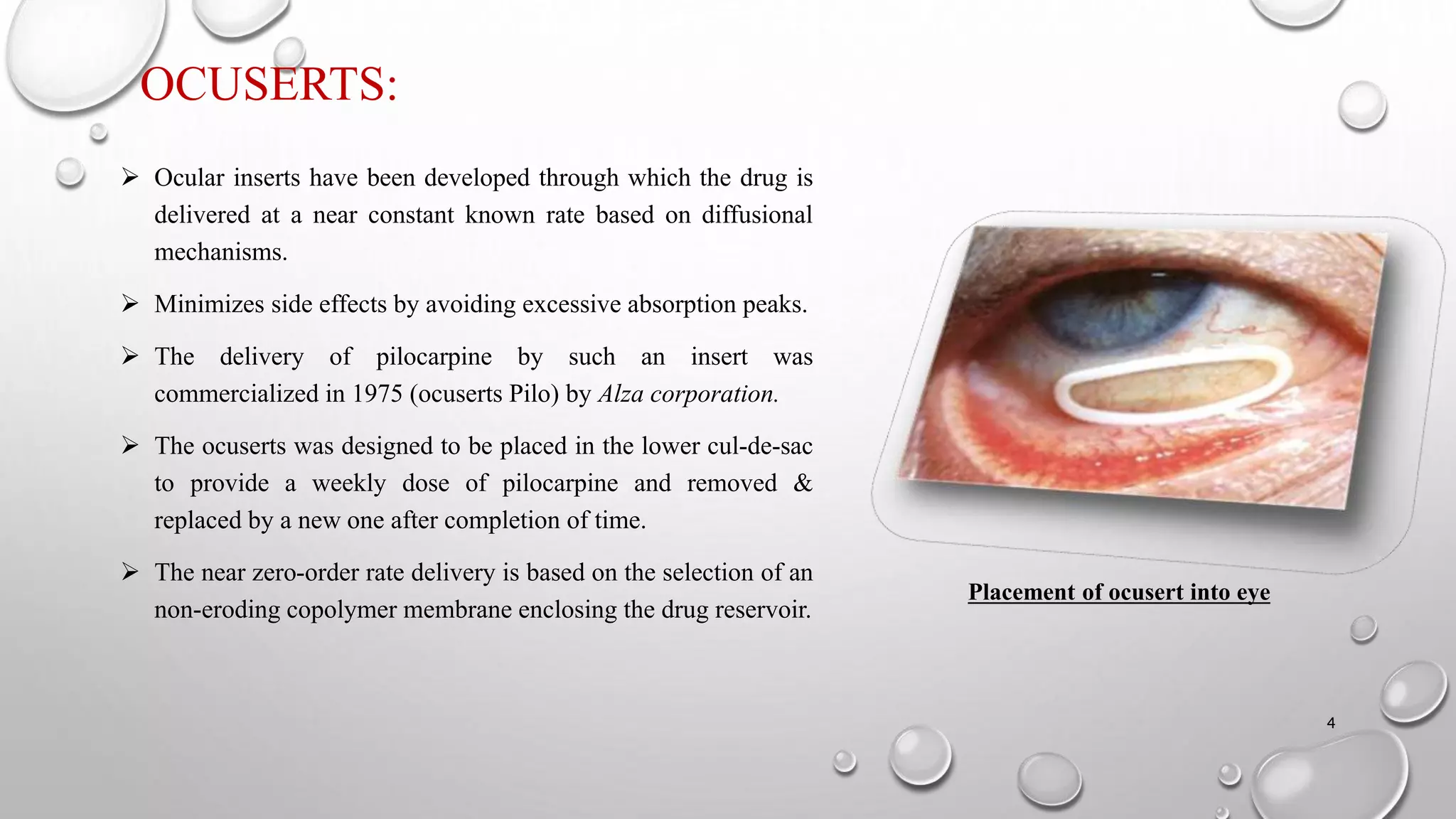 OCUSERTS:
 Ocular inserts have been developed through which the drug is
delivered at a near constant known rate based on diffusional
mechanisms.
 Minimizes side effects by avoiding excessive absorption peaks.
 The delivery of pilocarpine by such an insert was
commercialized in 1975 (ocuserts Pilo) by Alza corporation.
 The ocuserts was designed to be placed in the lower cul-de-sac
to provide a weekly dose of pilocarpine and removed &
replaced by a new one after completion of time.
 The near zero-order rate delivery is based on the selection of an
non-eroding copolymer membrane enclosing the drug reservoir.
Placement of ocusert into eye
4
 