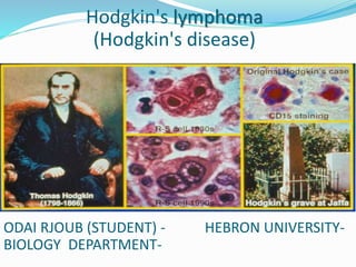 Hodgkin's lymphoma
(Hodgkin's disease)
ODAI RJOUB (STUDENT) - HEBRON UNIVERSITY-
BIOLOGY DEPARTMENT-
 