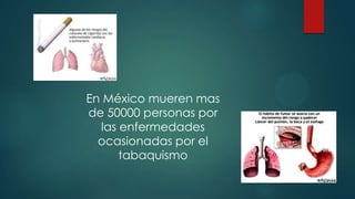 En México mueren mas
de 50000 personas por
las enfermedades
ocasionadas por el
tabaquismo
 