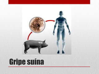 Gripe suína
 