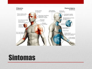 Sintomas
 