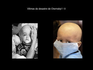 Vítimas do desastre de Chernobyl !   
