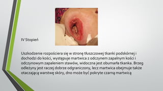 IV Stopień
Uszkodzenie rozpościera się w stronę tłuszczowej tkanki podskórnej i
dochodzi do kości, występuje martwica z odczynem zapalnym kości i
odczynowym zapaleniem stawów, widoczna jest obumarła tkanka. Brzeg
odleżyny jest raczej dobrze odgraniczony, lecz martwica obejmuje także
otaczającą warstwę skóry, dno może być pokryte czarną martwicą
 