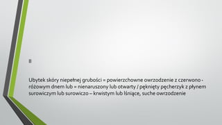 II
Ubytek skóry niepełnej grubości = powierzchowne owrzodzenie z czerwono -
różowym dnem lub = nienaruszony lub otwarty / pęknięty pęcherzyk z płynem
surowiczym lub surowiczo – krwistym lub lśniące, suche owrzodzenie
 