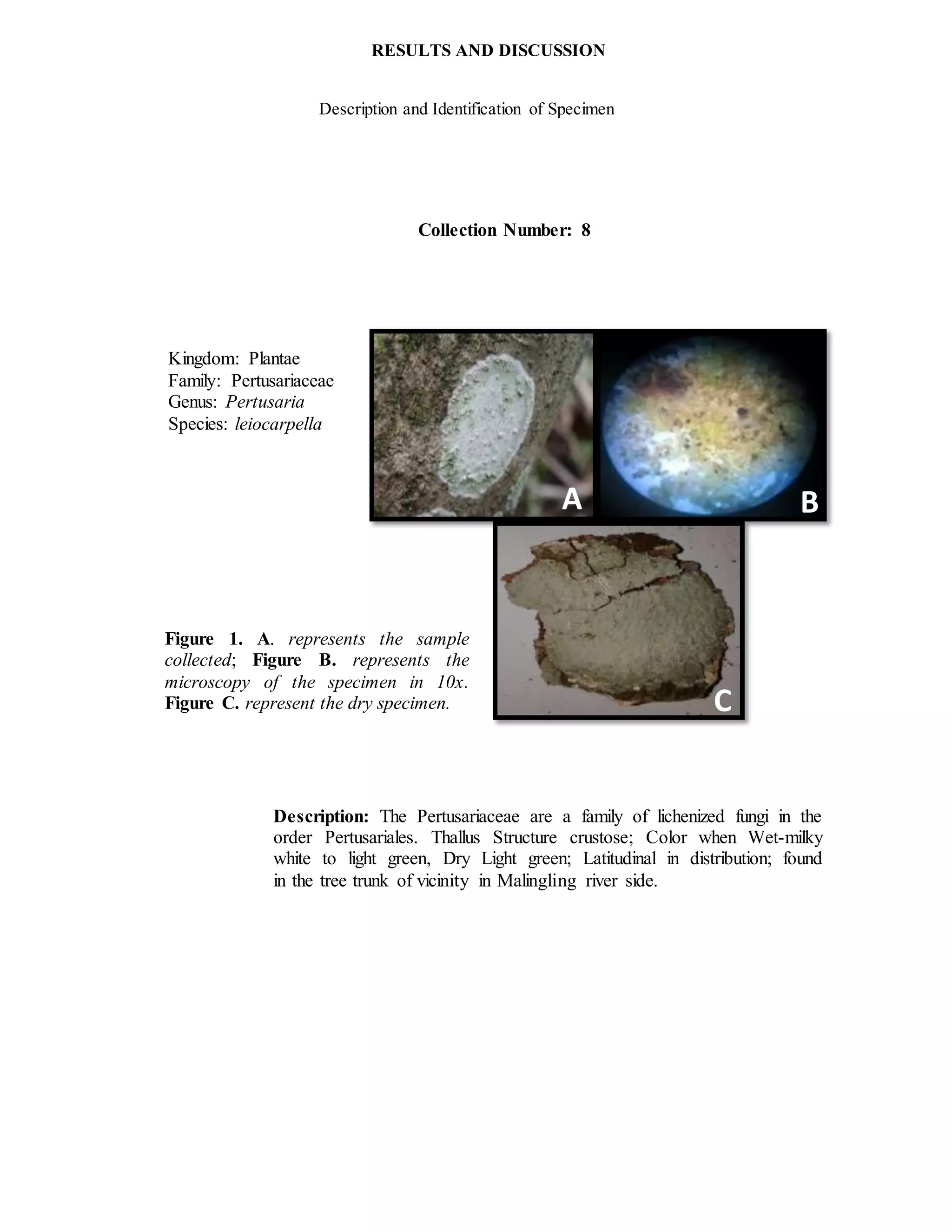 Collection Number: 8
Kingdom: Plantae
Family: Pertusariaceae
Genus: Pertusaria
Species: leiocarpella
Figure 1. A. represents the sample
collected; Figure B. represents the
microscopy of the specimen in 10x.
Figure C. represent the dry specimen.
Description: The Pertusariaceae are a family of lichenized fungi in the
order Pertusariales. Thallus Structure crustose; Color when Wet-milky
white to light green, Dry Light green; Latitudinal in distribution; found
in the tree trunk of vicinity in Malingling river side.
RESULTS AND DISCUSSION
Description and Identification of Specimen
A B
C
C
 