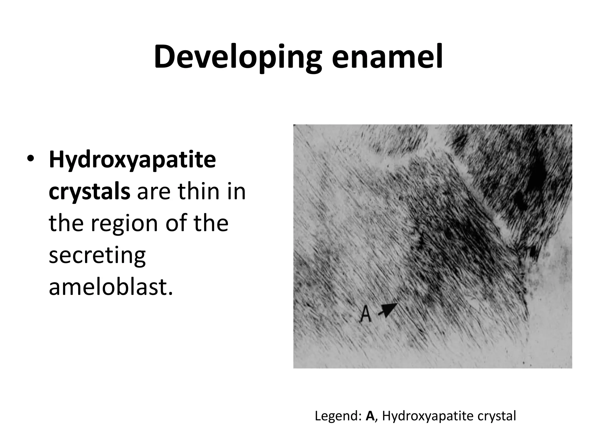 Developing enamel

• Hydroxyapatite
  crystals are thin in
  the region of the
  secreting
  ameloblast.



                         Legend: A, Hydroxyapatite crystal
 
