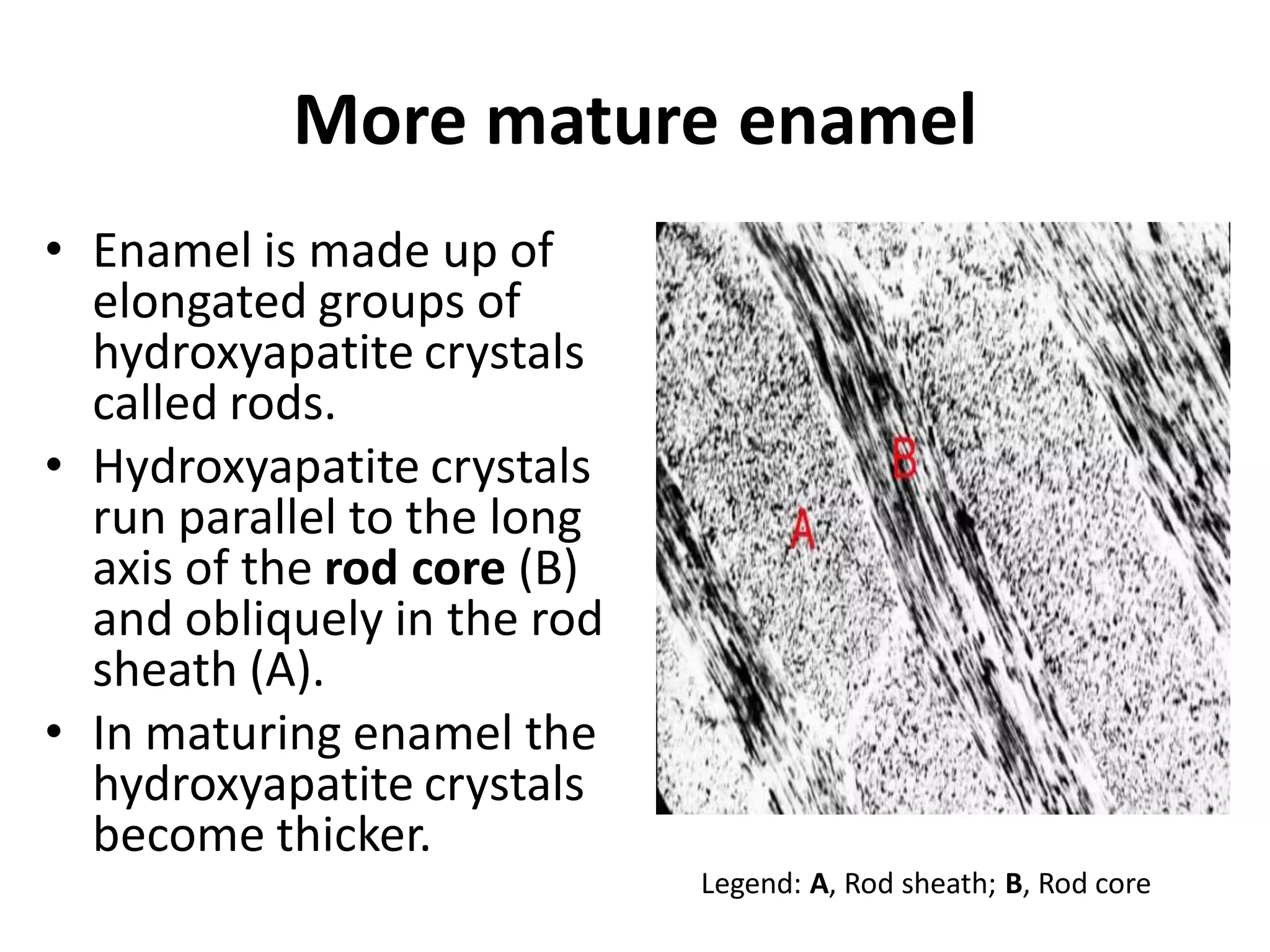 More mature enamel
• Enamel is made up of
  elongated groups of
  hydroxyapatite crystals
  called rods.
• Hydroxyapatite crystals
  run parallel to the long
  axis of the rod core (B)
  and obliquely in the rod
  sheath (A).
• In maturing enamel the
  hydroxyapatite crystals
  become thicker.
                             Legend: A, Rod sheath; B, Rod core
 