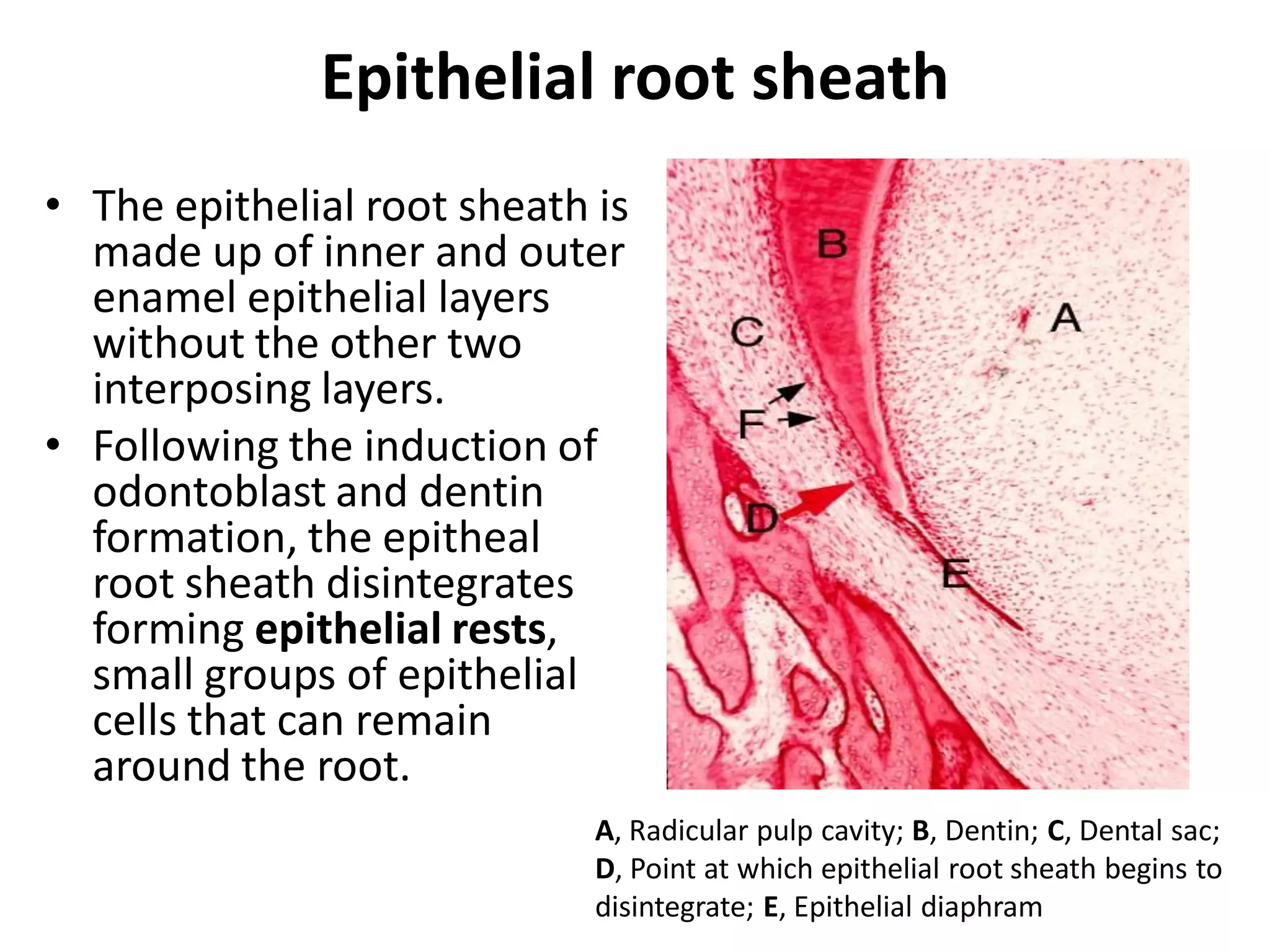 Epithelial root sheath
• The epithelial root sheath is
  made up of inner and outer
  enamel epithelial layers
  without the other two
  interposing layers.
• Following the induction of
  odontoblast and dentin
  formation, the epitheal
  root sheath disintegrates
  forming epithelial rests,
  small groups of epithelial
  cells that can remain
  around the root.
                             A, Radicular pulp cavity; B, Dentin; C, Dental sac;
                             D, Point at which epithelial root sheath begins to
                             disintegrate; E, Epithelial diaphram
 