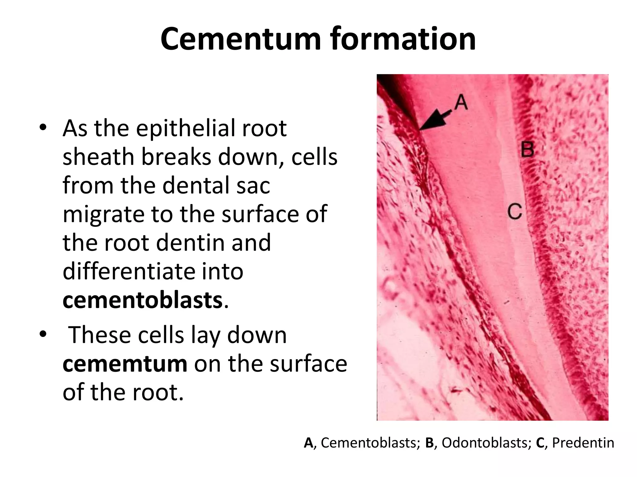 Cementum formation

• As the epithelial root
  sheath breaks down, cells
  from the dental sac
  migrate to the surface of
  the root dentin and
  differentiate into
  cementoblasts.
• These cells lay down
  cememtum on the surface
  of the root.
                       A, Cementoblasts; B, Odontoblasts; C, Predentin
 