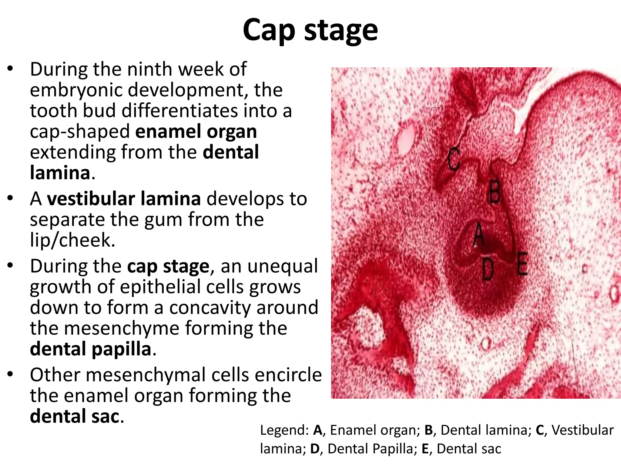 Cap stage
• During the ninth week of
  embryonic development, the
  tooth bud differentiates into a
  cap-shaped enamel organ
  extending from the dental
  lamina.
• A vestibular lamina develops to
  separate the gum from the
  lip/cheek.
• During the cap stage, an unequal
  growth of epithelial cells grows
  down to form a concavity around
  the mesenchyme forming the
  dental papilla.
• Other mesenchymal cells encircle
  the enamel organ forming the
  dental sac.
                           Legend: A, Enamel organ; B, Dental lamina; C, Vestibular
                           lamina; D, Dental Papilla; E, Dental sac
 