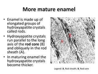 More mature enamel
• Enamel is made up of
  elongated groups of
  hydroxyapatite crystals
  called rods.
• Hydroxyapatite crystals
  run parallel to the long
  axis of the rod core (B)
  and obliquely in the rod
  sheath (A).
• In maturing enamel the
  hydroxyapatite crystals
  become thicker.
                             Legend: A, Rod sheath; B, Rod core
 